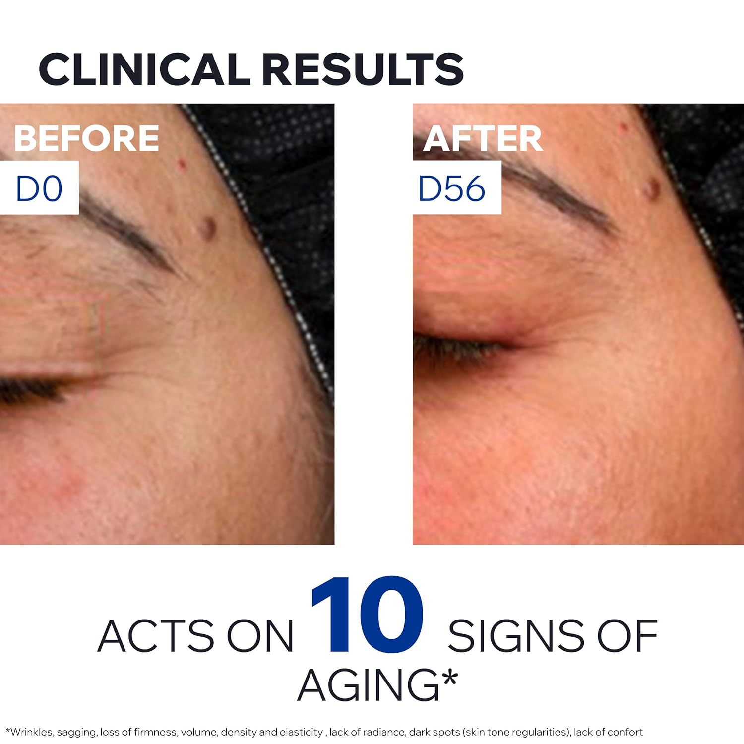 Uriage Age Absolu Collagen Booster Micro-Redensifying Serum With Procollagen Peptides & Retinol, Plumping Effect, Wrinkles, Radiance, Volume, Non-Greasy Finish